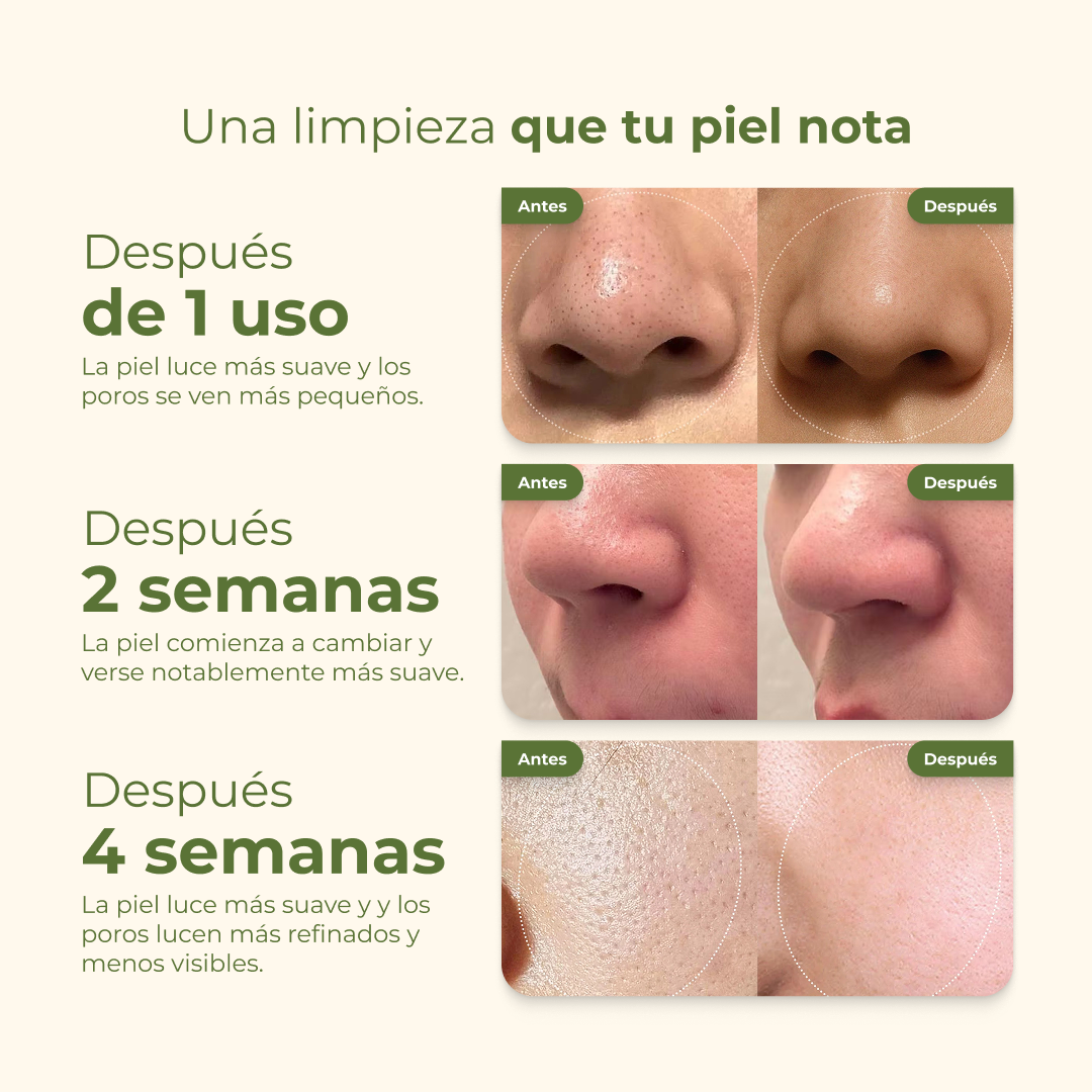 Mascarilla coreana para puntos negros — sin irritar piel sensible