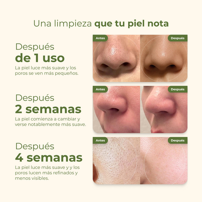 Mascarilla coreana para puntos negros — sin irritar piel sensible